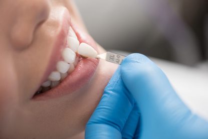 Denturologie : une expertise en prothèses dentaires
